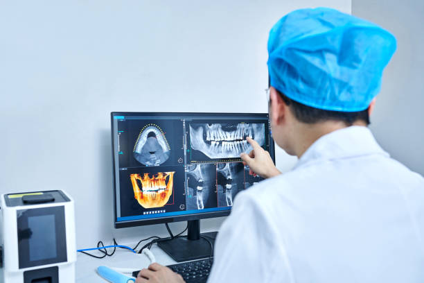 Best Emergency Wisdom Tooth Extraction in Rothsville, PA